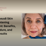 Morpheus8 Skin Tightening Treatment: Benefits, Procedure, and Results