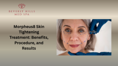 Morpheus8 Skin Tightening Treatment: Benefits, Procedure, and Results