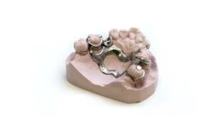 Affordable Dental Care Without Compromising Quality